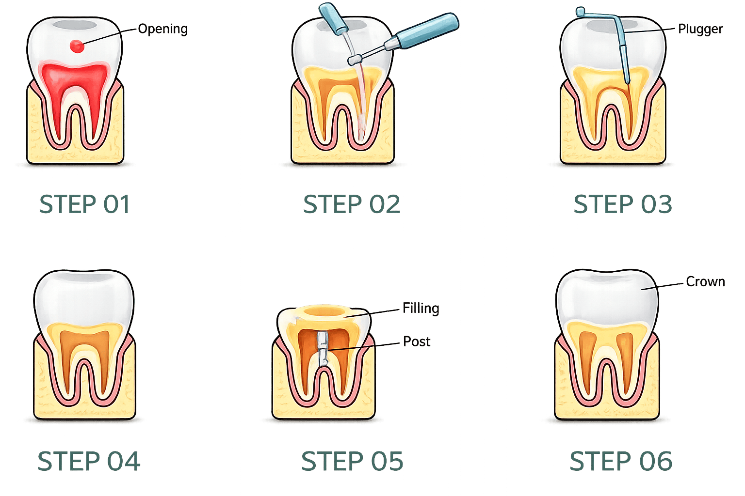 Procedure